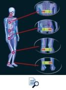 sensomotorische einlage zukunft sensoped seidl regensburg 3d 3d-scanner orthopdieschuhtechnik