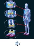 sensomotorische einlage zukunft sensoped seidl regensburg 3d 3d-scanner orthopdieschuhtechnik